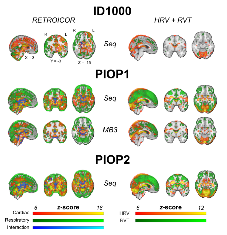 Results from group-level physiology analyses. Brain maps show uncorrected effects (thresholded arbitrarily at z > 6) and were linearly interpolated for visualization in FSLeyes. Unthresholded whole-brain z-value maps are available on NeuroVault.