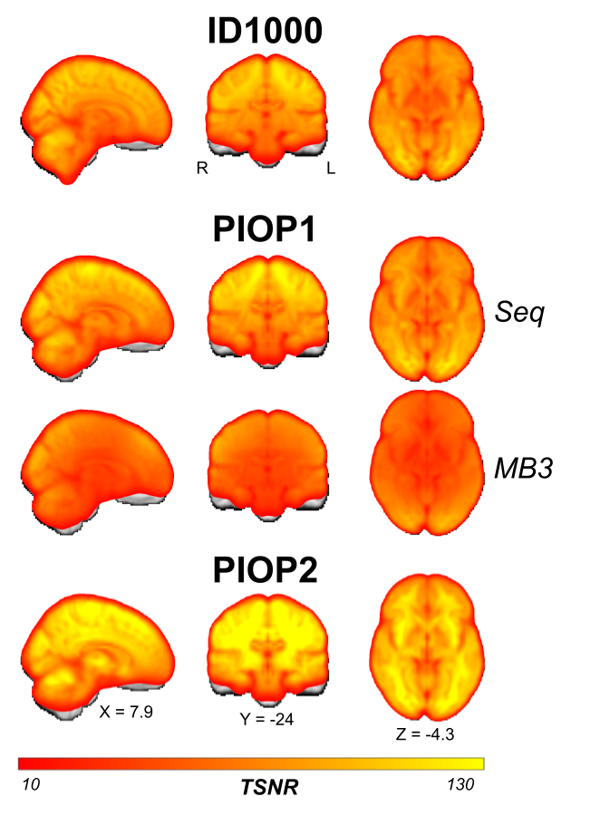 Average (across subjects and runs) temporal signal-to-noise (tSNR) maps of each type of functional (BOLD) MRI scan in each dataset. Unthresholded whole-brain tSNR maps are available on NeuroVault.